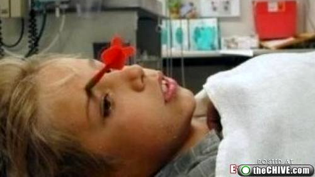 Sageata de darts infipta in capul unui copil