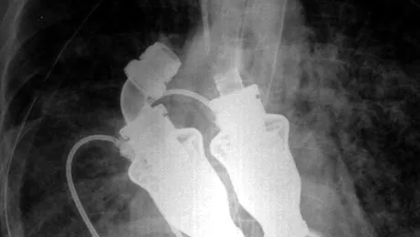 Viata fara puls este o realitate