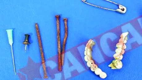 Au inghitit proteze si linguri, odata cu mancarea