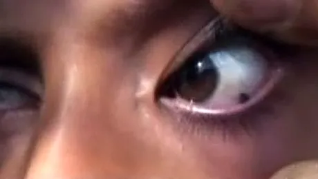 O fetiță de 12 ani plânge cu pietre