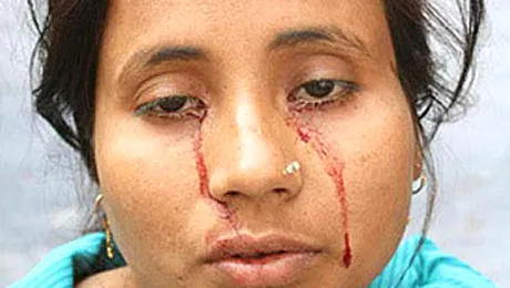 O indianca plange cu lacrimi de sange