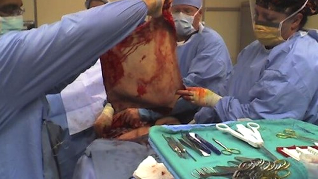 david smith pe masa de operatii