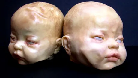 La ce este bună ciocolata albă