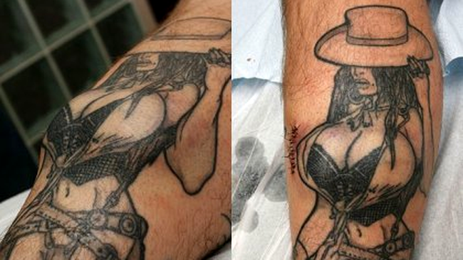 Implant de silicoane pentru un tatuaj