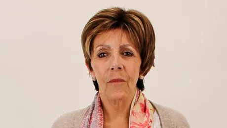 I-a „căzut” fața după ce și-a făcut lifting