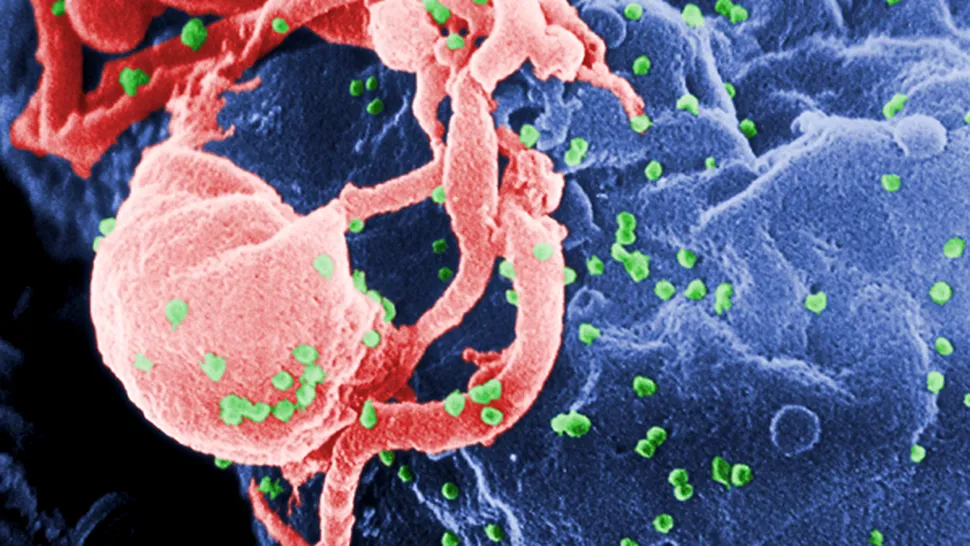Virusul HIV, eliminat 91% de un anticorp nou!