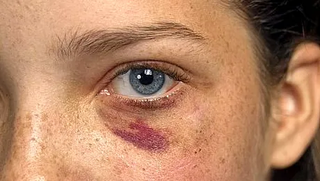 Bancul zilei: Te iubesc, sa moara mama!