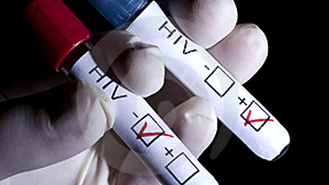 test hiv