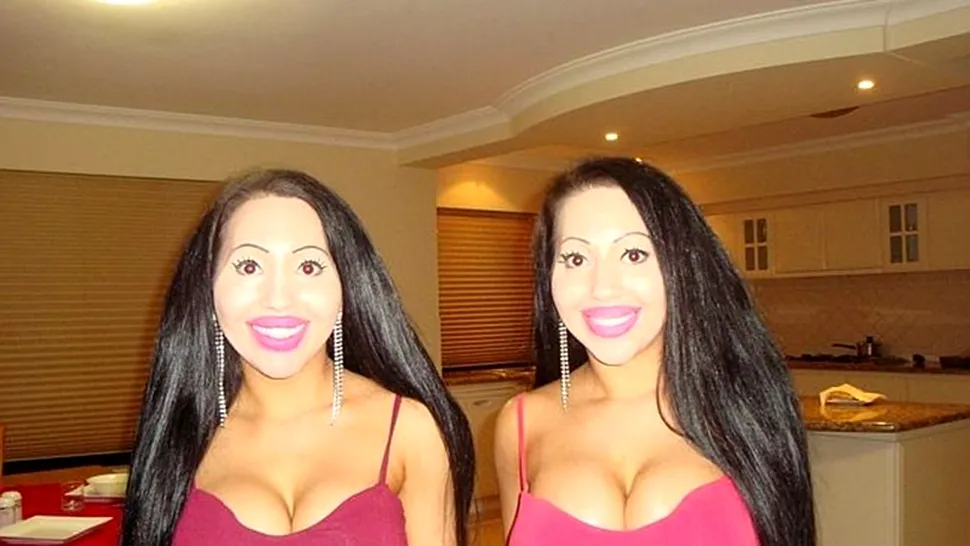 Două gemene australiene și-au făcut operații estetice pentru a arăta identic