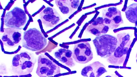 De unde vin bacteriile?