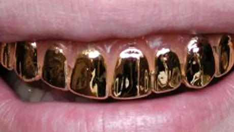 Dintii de aur ai unui barbat au ricosat glontul care putea sa il omoare