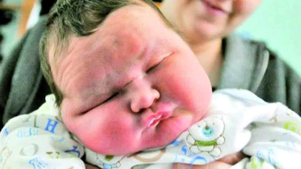 Cel mai gras bebelus din lume: a avut la nastere 7,54 de kilograme