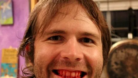 Bărbatul dependent de carne crudă