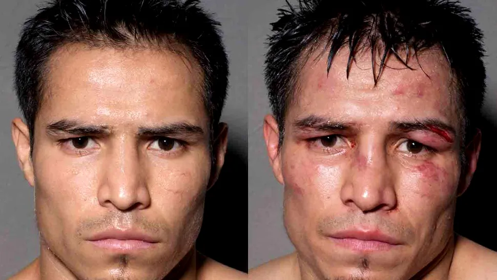 ARTA MUTILĂ‚RII: Boxeri, înainte și după meciuri (POZE)