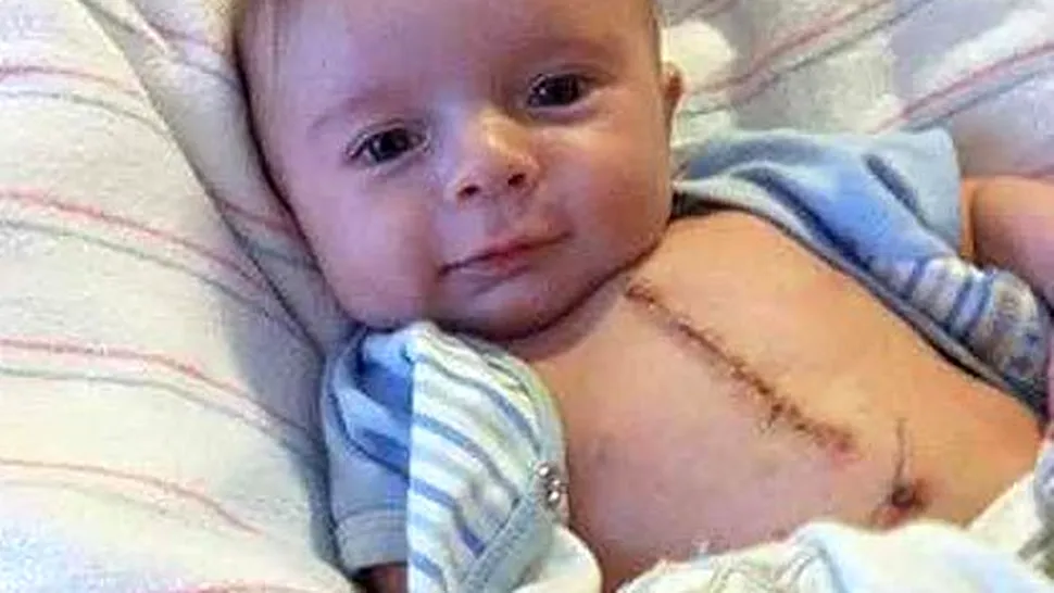 Bebelușul OPERAT care arată ridicol de BINE