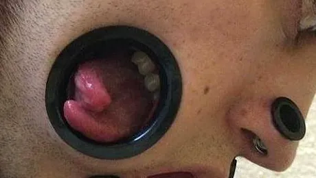 S-a automutilat pentru a semăna cu idolul său, Omul Diavolului