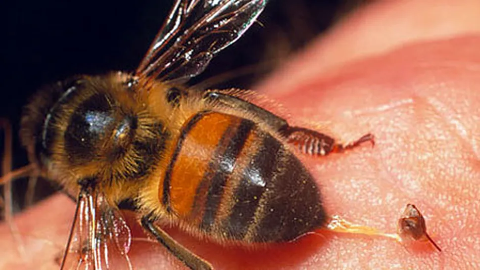 Cele mai dureroase locuri în care te poate înțepa o albină
