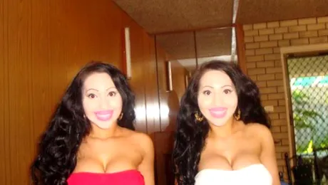 Gemenele identice care împart totul, chiar și iubitul