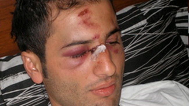 Racaj Berat, chelnerul agresat de Adrian Mutu