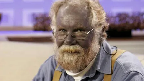 „Omul albastru” a murit, la 62 de ani