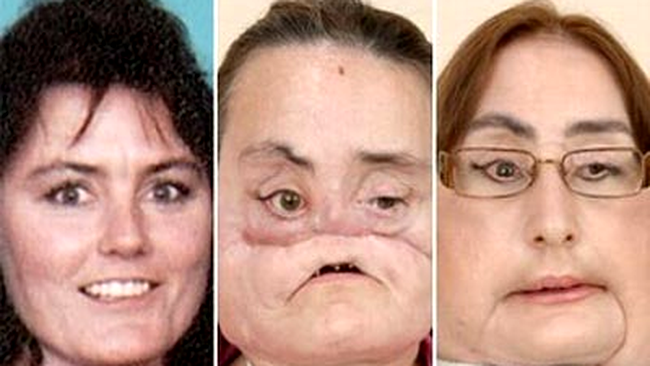 Connie Culp, inainte si dupa groaznica intamplare din viata sa!