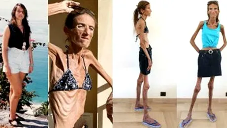 Cea mai slabă femeie din lume, cântărită la “Acces direct”