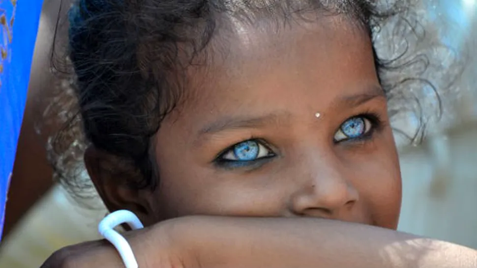 
Blestemul celor mai frumoşi ochi din lume! Drama fetiţei cu ochi de diamant
