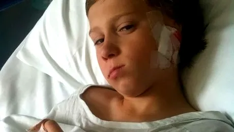 Un băiat născut fără o ureche a primit una creată din propriile coaste