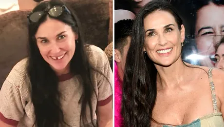 Demi Moore, fără dinţi din cauza stresului. Cum arată acum actriţa –  FOTO