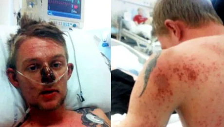 Era sa moară din cauza unei pastile banale pentru durere