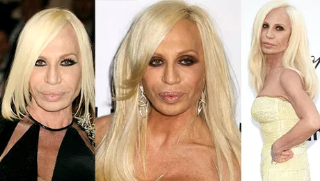 Donatella Versace, un chip distrus de prea mult Botox. Cum s-a schimbat de-a lungul timpului