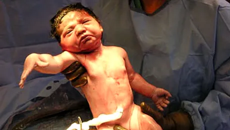 Viitoarea mamica nu stia ca este gravida!