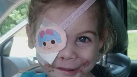 Desfigurată de câini, a fost dată afară dintr-un KFC, pentru că speria clienții!