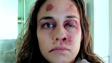 O tânără s-a pozat după fiecare bătaie primită de la iubit (Video)
