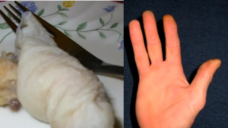 Și-a gătit și mâncat propriul deget amputat
