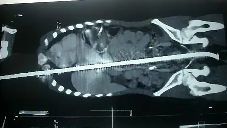 Un baiat a supravietuit dupa ce o tija i-a strapuns 10 organe vitale