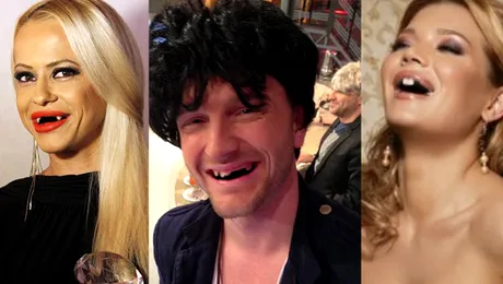 45 de vedete fără dinți (Poze)