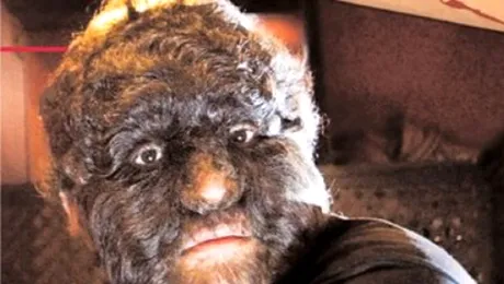 Salvarea cheliosilor ar putea fi „gena varcolacului”