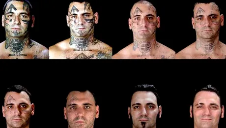 Un barbat a trecut prin 25 de operatii pentru a-si sterge „semnele urii” de pe fata