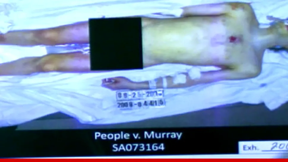 Poza cu Michael Jackson gol, pe masa de autopsie