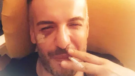 Răzvan Ciobanu a recunoscut că a fost bătut de iubit: „M-a lovit cu un scaun de metal” – FOTO