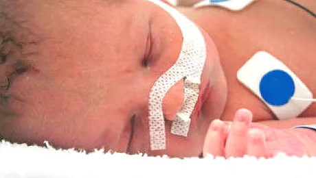 O mama nebuna si-a muscat bebelusul de cap si o mana