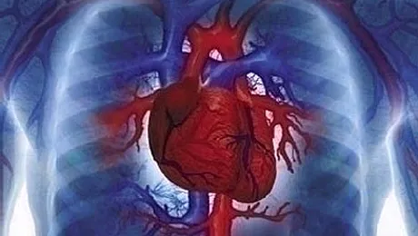 Tineretea Romaniei sufera de infarct miocardic!