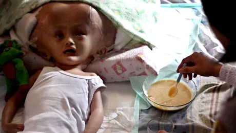 Fetița-extraterestru: Ce boală ar putea ucide-o în orice clipă