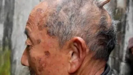 Barbatul-drac: i-a crescut un corn in cap!