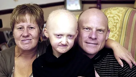 Fetita care poate muri din cauza caldurii