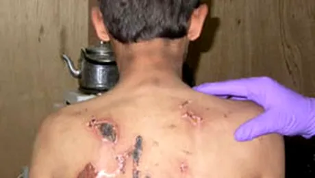 Canada: SUA si Israelul tolereaza acte de tortura