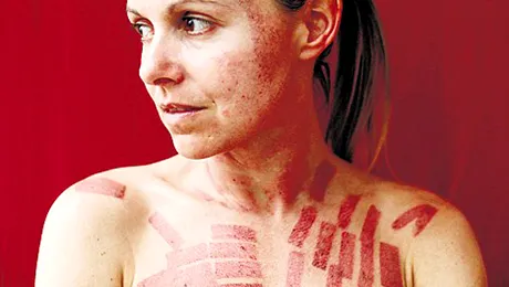 Ce a patit o femeie in urma unui tratament pentru infrumusetare