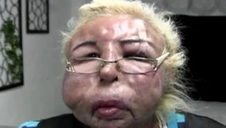 Și-a desfigurat fața din dorința de a arăta perfect