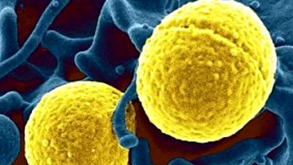 O nouă bacterie amenință omenirea!